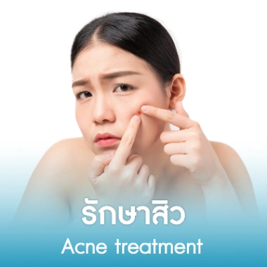 รักษาสิว