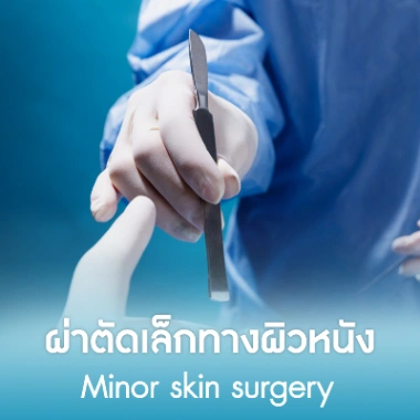 ผ่าตัดเล็กทางผิวหนัง