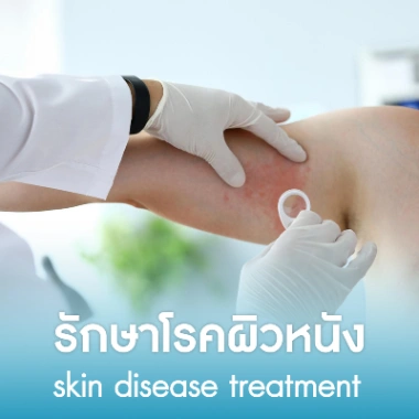 รักษาโรคผิวหนัง