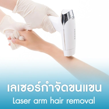 เลเซอร์กำจัดขนแขน