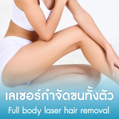 เลเซอร์กำจัดขนทั้งตัว