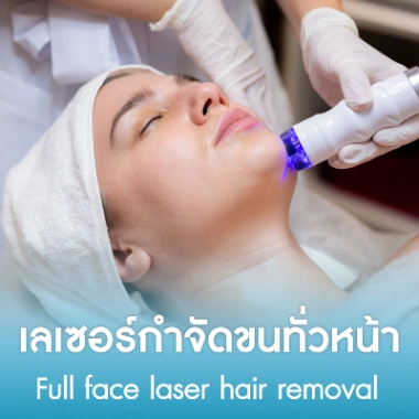 เลเซอร์กำจัดขนทั่วหน้า