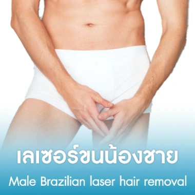 เลเซอร์ขนน้องชาย