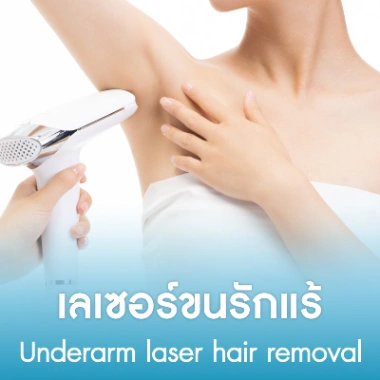 เลเซอร์ขนรักแร้