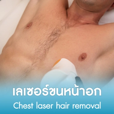 เลเซอร์ขนหน้าอก