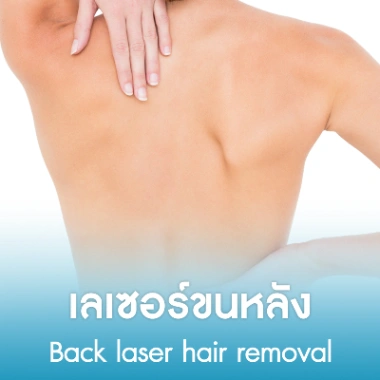 เลเซอร์ขนหลัง