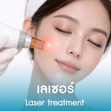 เลเซอร์