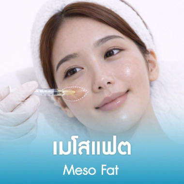 เมโสแฟต