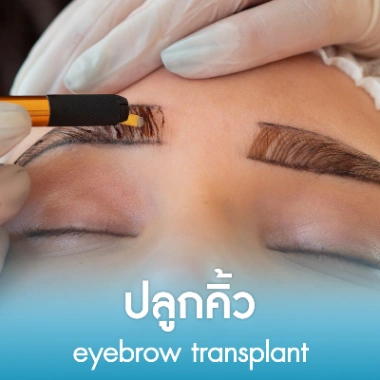 ปลูกคิ้ว