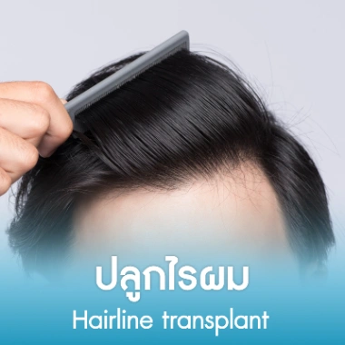 ปลูกไรผม