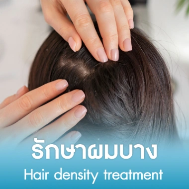 รักษาผมบาง