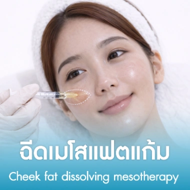 ฉีดเมโสแฟตแก้ม