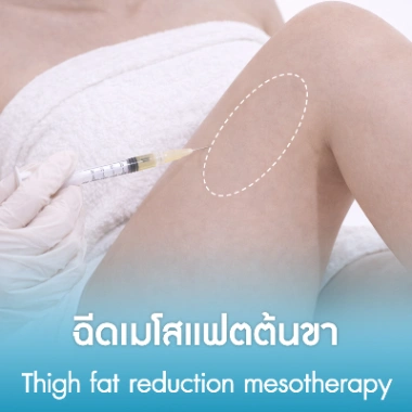 ฉีดเมโสแฟตต้นขา
