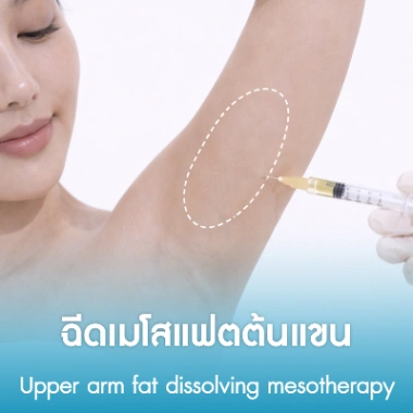 ฉีดเมโสแฟตต้นแขน
