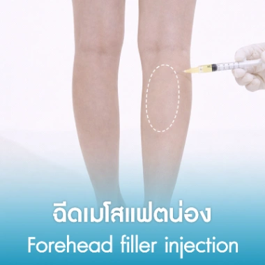 ฉีดเมโสแฟตน่อง