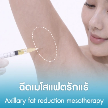 ฉีดเมโสแฟตรักแร้