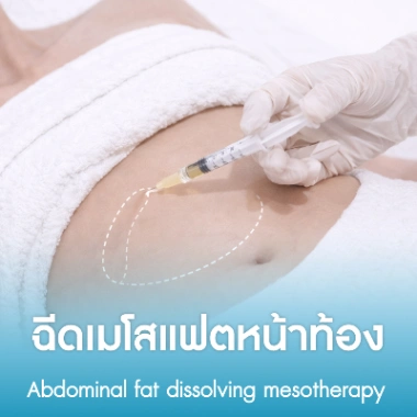 ฉีดเมโสแฟตหน้าท้อง