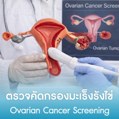 ตรวจคัดกรองมะเร็งรังไข่