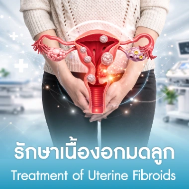 รักษาเนื้องอกมดลูก