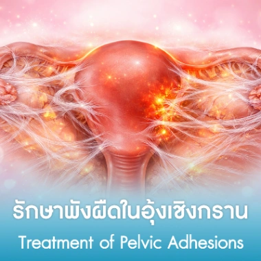 รักษาพังผืดในอุ้งเชิงกราน