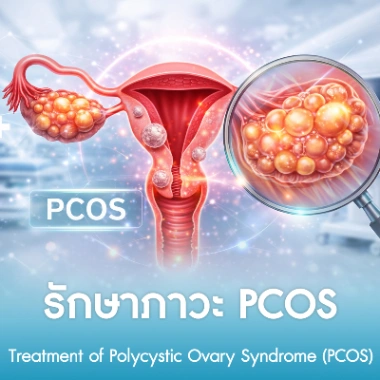 รักษาภาวะ PCOS