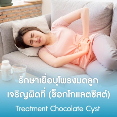 รักษาเยื่อบุโพรงมดลูกเจริญผิดที่ (ช็อกโกแลตซีสต์)