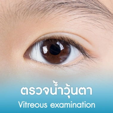 ตรวจน้ำวุ้นตา
