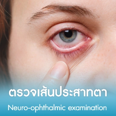 ตรวจเส้นประสาทตา