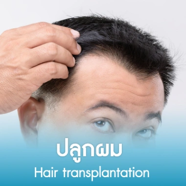 ปลูกผม 