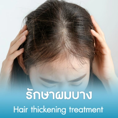 รักษาผมบาง